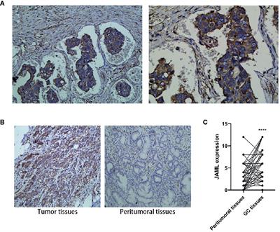 Junctional Adhesion Molecule-Like Protein Promotes Tumor Progression and Metastasis via p38 Signaling Pathway in Gastric Cancer